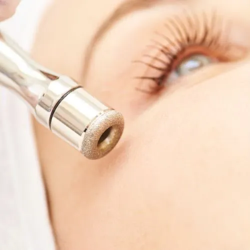 Microdermabrasion